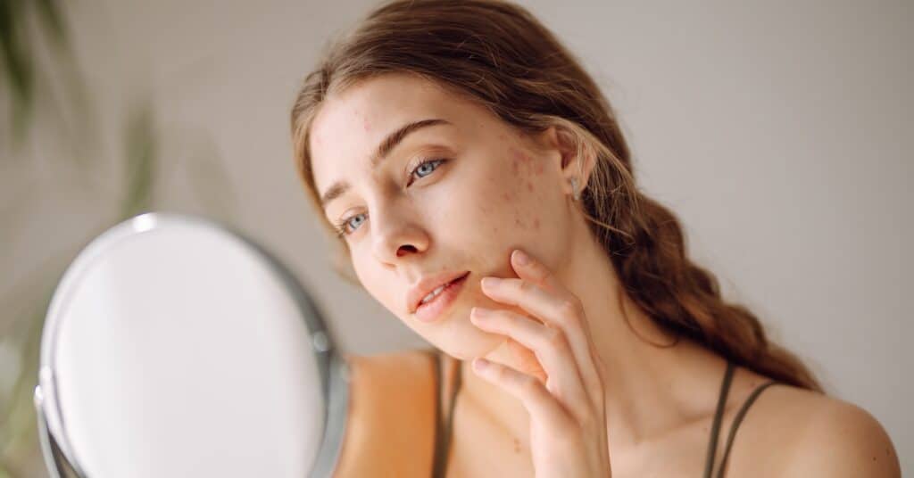 collagen cicatrisation